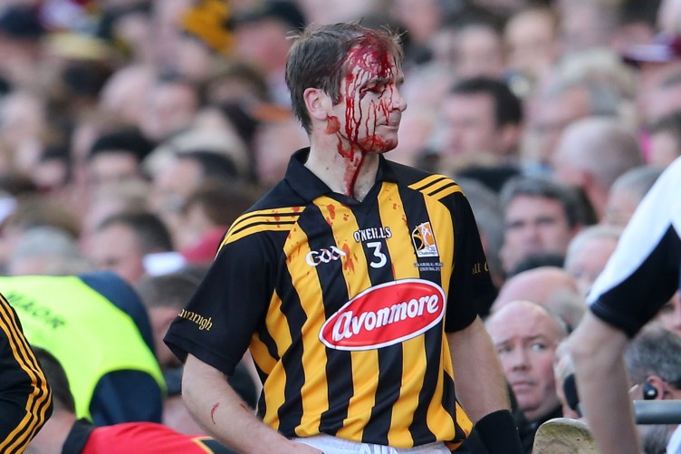 jj-delaney-leaves-the-pitch-for-a-blood-injury-752x501.jpg