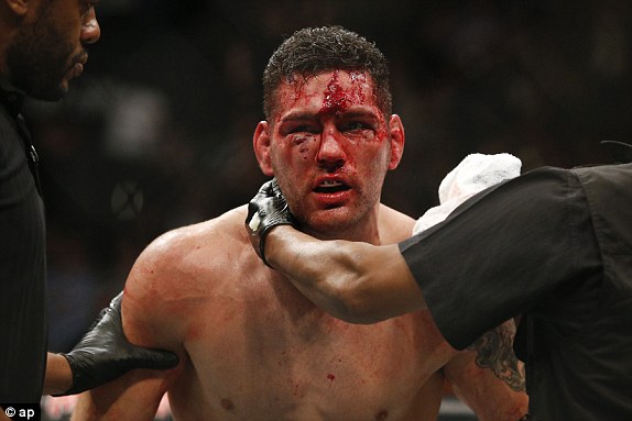 1449984713762_lc_galleryImage_Chris_Weidman_is_attended.JPG