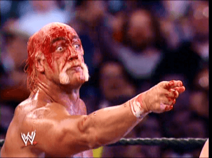 Hulk-Hogan-bleeding.png
