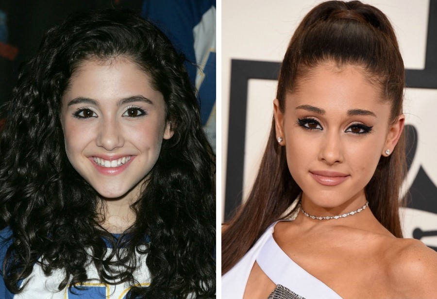 Ariana-Grande-before-and-after-plastic-surgery-01.jpg